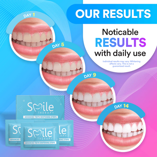 Teeth Whitening & Cleaning Strips