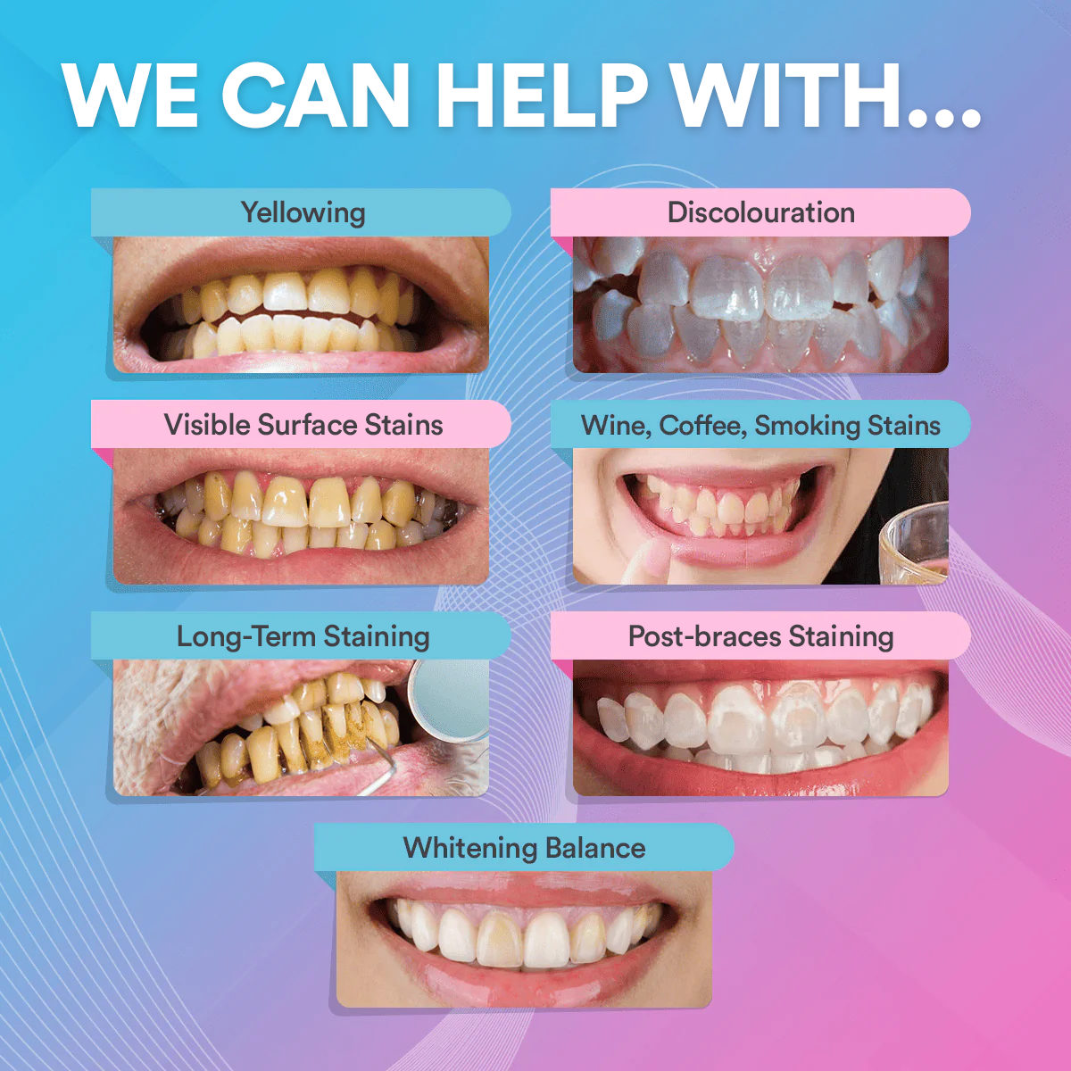 Teeth Whitening & Cleaning Strips
