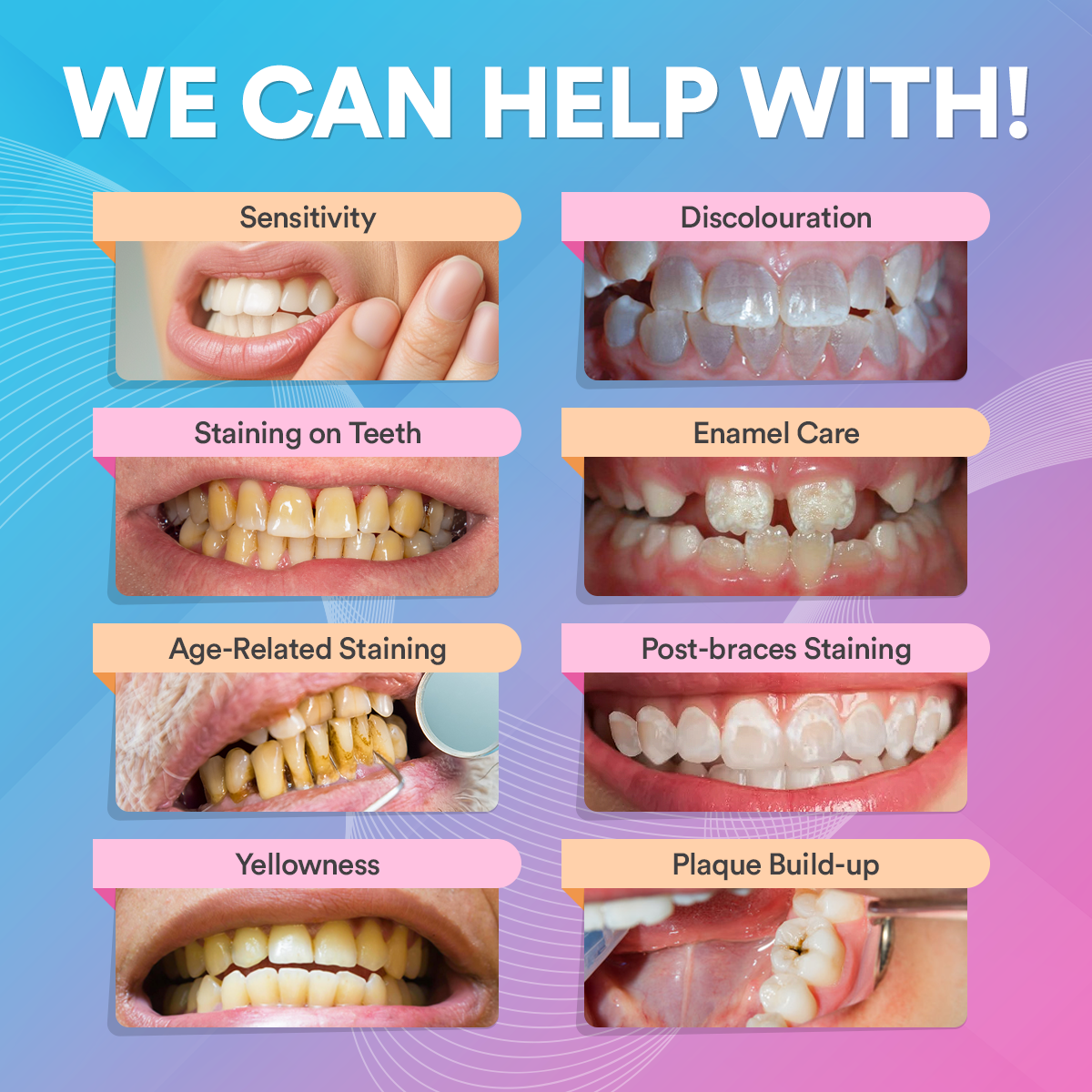 Advanced PAP+ Teeth Whitening Kit DP12