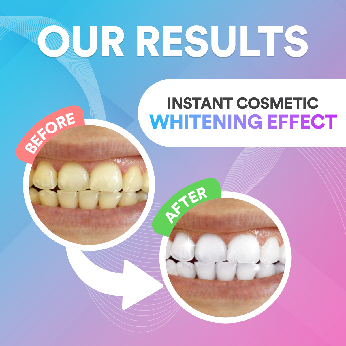 Teeth Whitening Pen DP4