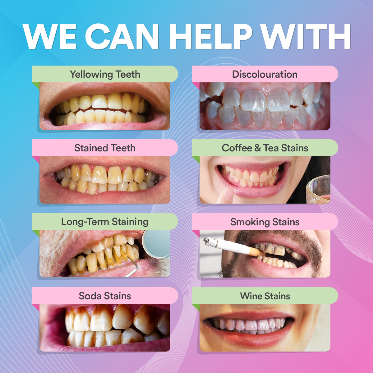 Teeth Whitening Pen DP4