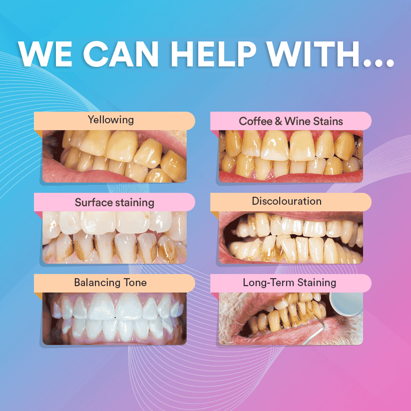 V34 Colour Corrector | Purple Teeth Whitening Toothpaste | Advanced Stain Removal