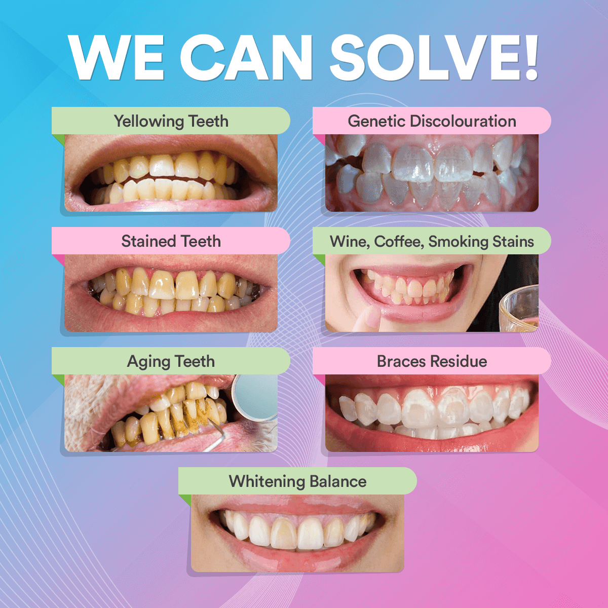 PAP+ Pro Teeth Whitening Powder DP10