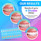 Advanced PAP+ Teeth Whitening Kit DP12